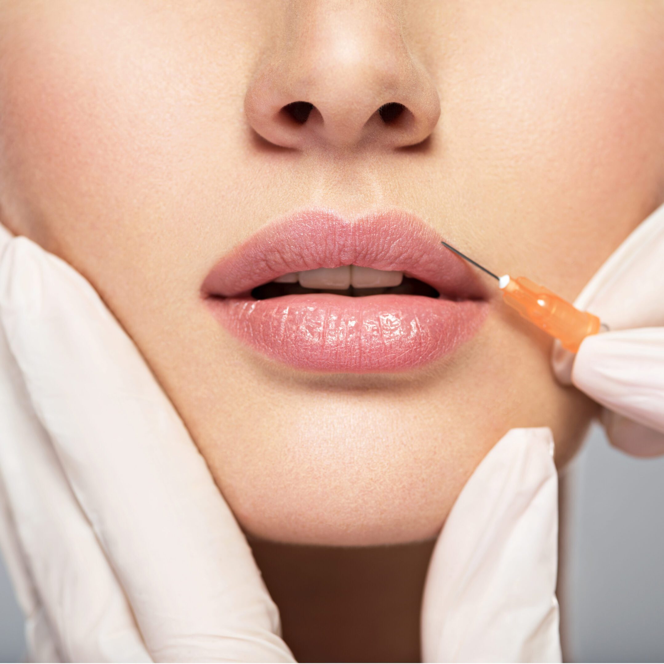 lip filler, piele, medical spa